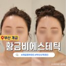 개금성원상떼뷰오피스텔 | 부산윤곽잘하는곳 개금피부관리 황금비에스테틱 작은얼굴만들기