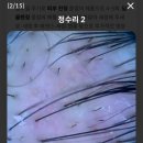 모스테틱광주