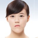 뼈연구소 네이버블로그