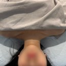 [공지] 광명 에스테틱 소담손길에서 예신 관리! 쇄골 되찾은 후기