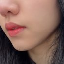 PDRN앰플 추천│모공, 색소침착, 탄력개선에 좋은 '루벨리 PDRN 나노샷 100 스킨부스트 RX 앰플' 솔직후기