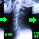 바른자세교정 이미지