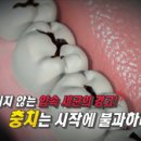 [엄지의 제왕]당뇨·치매· 암, 중증질환 부르는 입속 세균 잡는 법 이미지