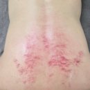 파리바게뜨백석아이파크점 | 천안 바디관리 영바디케어 가마열테라피 전신관리 솔직후기