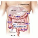 대장암의 진단과 치료 예방법 이미지