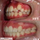 연세미소담은치과 이미지