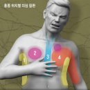 흉통(胸痛) 유발 요인, 심장 질환 외에도 많다 이미지