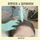모리바이브 | 산후탈모 서산두피케어 온엔오프x모리바이브 재방문 후기