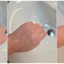 Y메딕스 이미지