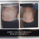럭키케어