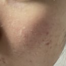 [체험단] 피부 건조, 장벽 강화, 아토피에 효과 좋은 쿼드쎄라 뷰티 디바이스