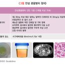 만성 이미지