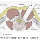 경산신경외과의원 | 대구척추MRI, 정상인데 계속 아파요 [서부통신경외과] 허리디스크, 달서구, 대명동, 송현동, 서부정류장역