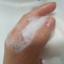 아무꺼나 | 동전습진 물러가랏! 제로토피아 크림&amp;바 사용 후기