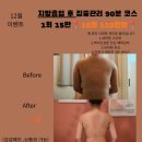 미쁘다피부/체형 | 여수 지방흡입 사후관리 잘하는곳 팔 지방흡입 3일차 / 바이오본드 고주파관리
