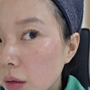 이지이샵 | 엘라스티 포스트랩 재생크림 후기 스킨보톡스 시술 후 홈쥬란 케어로 사용해본 솔직 리뷰