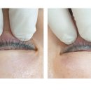 브라운아이의원 이미지