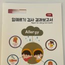 MAST 알러지 검사 후기