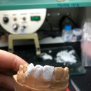 수인치과기공소 이미지