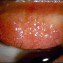 이노티 안경콘택트렌즈 이미지