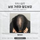 두두스칼프
