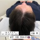 두두스칼프