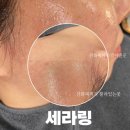 바이밍 이미지