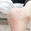 반송동133 | 동탄 반송동 발각질 관리 전문샵 레푸스동탄반송점