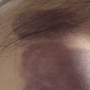 스타 바디핏 | [💰내돈내산💵] Well247 바디컷튠핏 찐 솔직후기✨ |부황+괄사 마사지기| 비포•에프터 🙆🏻‍♀️