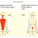 미쯔이식 주열 이미지