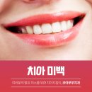 하얀부부치과의원 네이버블로그
