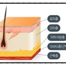 판교울쎄라 볼패임 부작용 후기가 자주 들리는 이유 &lt;필독&gt;