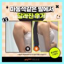 재임다이어트 | 365mc람스의원 영등포점 꼼꼼한 시술과 친절 상담이 돋보여요