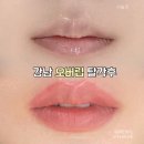대신디자인 | 강남입술문신, 필러대신 오버립 디자인으로 인중축소 효과본 후기