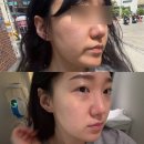 성수피부관리 [트리버에스테틱 성수] 속건조 홍조 열감 여드름케어 50분 후기