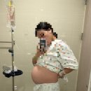 위대한정육점 | [출산기록] 초산모의 유도분만 2일차 후기! (feat. 좋은문화병원) 유도분만 끝 제왕엔딩/ 제왕분만 1일차