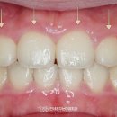 검암우리치과 네이버블로그