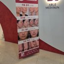 에이블메디 | 동탄 피부관리 상담 에이블 메디스킨 첫방문 내돈내산 후기