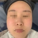 현대중공업 서부문 앞 | 동구올가뷰티 울산올가뷰티 동구여드름관리