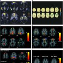 Re: 명상의 과학적 이해 default mode network 통시적 탐구 이미지