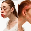 아바 헬스 이미지