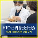 장편한외과의원 | HTO 근위경골절골술, 60대 여성 오다리 교정 후기