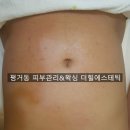 에스테틱 더힐 이미지