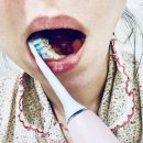 ”습관을 바꾸면 입속이 달라진다-소닉케어 다이아몬드클린 9000” 2개월 사용 후