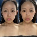 형곡킴스헤어뷰티샵 | 구미 형곡동 피부관리 카리테스뷰티 맞춤 페이스케어 후기