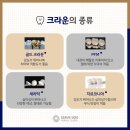 바른손치과기공소 네이버블로그