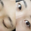 강남 더 뷰티 성형외과의원 Daum카페