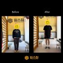 30대 직장인의 어깨 충돌증후군 극복 임스짐 재활 후기