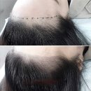 줌헤어라인
