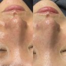 인셀덤팰리스 | 부산 서면 범내골역 범천동 리니뷰티 진정관리 수기관리 정액권 두번째결제 내돈내산 후기!